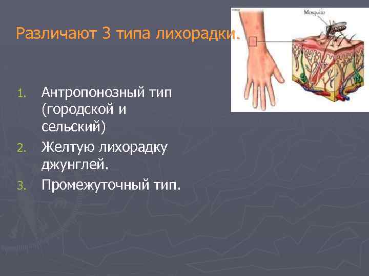 Различают 3 типа лихорадки. Антропонозный тип (городской и сельский) 2. Желтую лихорадку джунглей. 3.