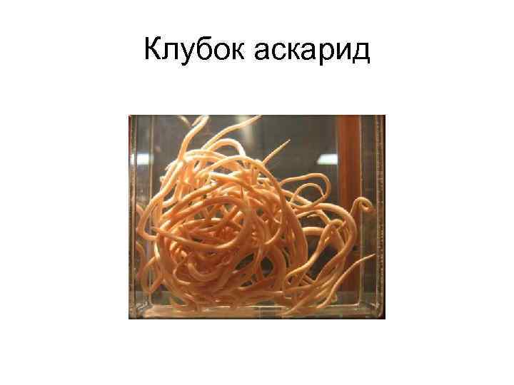 Клубок аскарид 