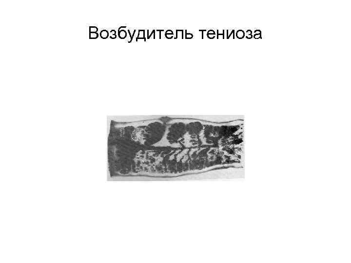 Возбудитель тениоза 
