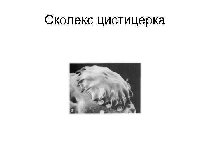 Сколекс цистицерка 