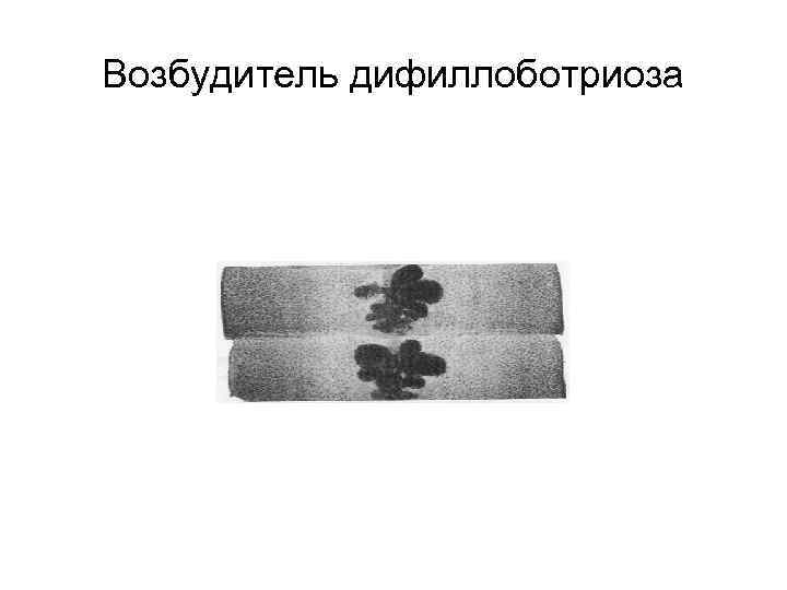 Возбудитель дифиллоботриоза 