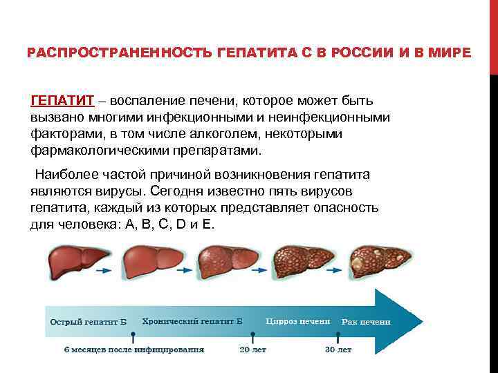 РАСПРОСТРАНЕННОСТЬ ГЕПАТИТА С В РОССИИ И В МИРЕ ГЕПАТИТ – воспаление печени, которое может