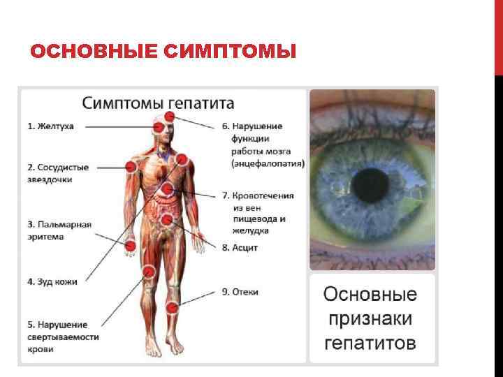 ОСНОВНЫЕ СИМПТОМЫ 