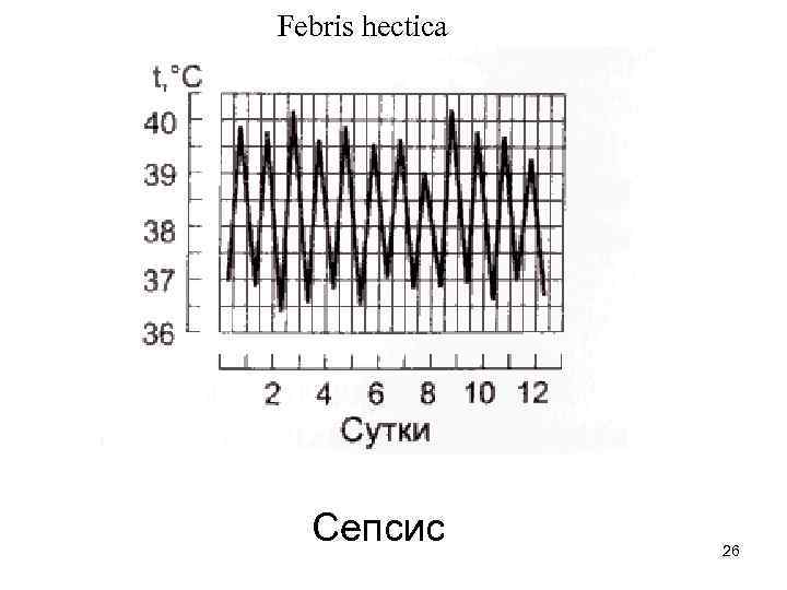 Febris hectica Сепсис 26 