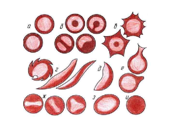 Морфология анемий. Различные формы эритроцитов. Форма эритроцитов в крови. Эритроциты разной формы. Формы эритроцитов при анемии.
