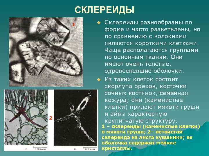 СКЛЕРЕИДЫ 1 u u 2 Склереиды разнообразны по форме и часто разветвлены, но по