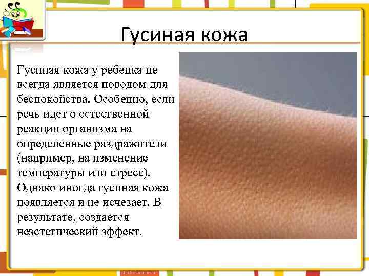 Гусиная кожа у ребенка не всегда является поводом для беспокойства. Особенно, если речь идет