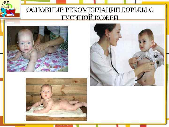 ОСНОВНЫЕ РЕКОМЕНДАЦИИ БОРЬБЫ С ГУСИНОЙ КОЖЕЙ 