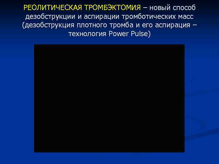 РЕОЛИТИЧЕСКАЯ ТРОМБЭКТОМИЯ – новый способ дезобструкции и аспирации тромботических масс (дезобструкция плотного тромба и