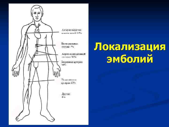 Карта вызова тромбоз артерии верхней конечности