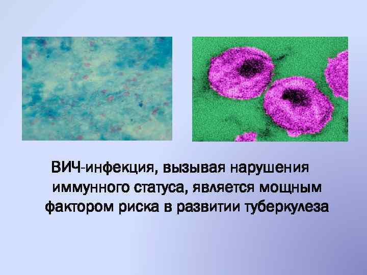 ВИЧ-инфекция, вызывая нарушения иммунного статуса, является мощным фактором риска в развитии туберкулеза 