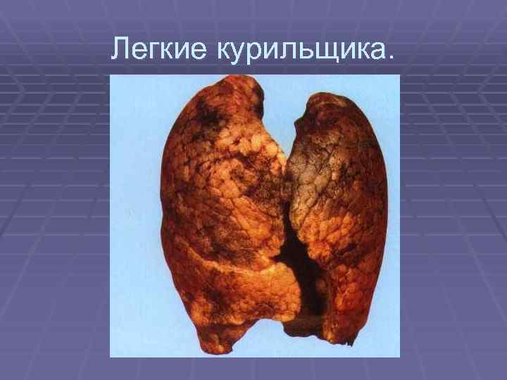 Легкие курильщика. 