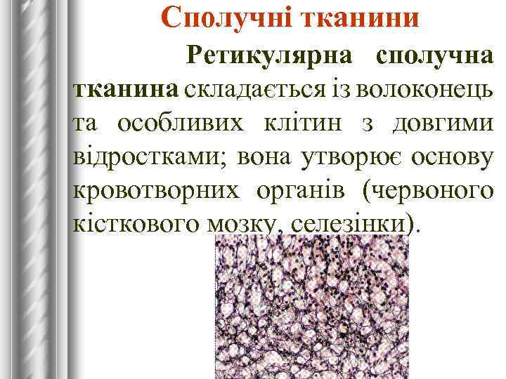 Сполучні тканини Ретикулярна сполучна тканина складається із волоконець та особливих клітин з довгими відростками;