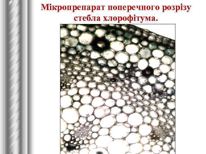 Мікропрепарат поперечного розрізу стебла хлорофітума. 