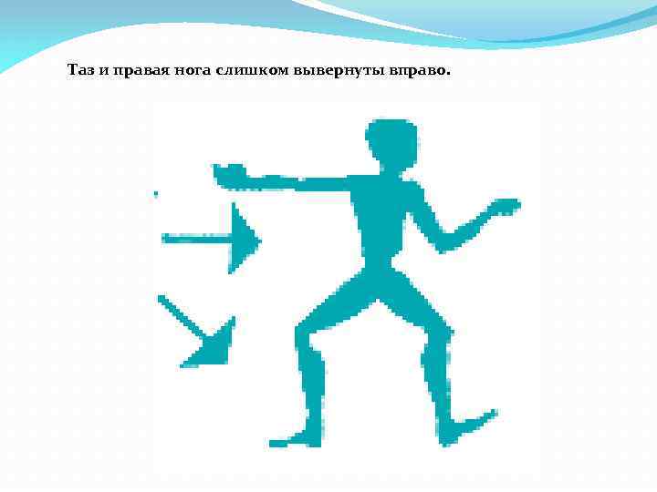 Таз и правая нога слишком вывернуты вправо. 