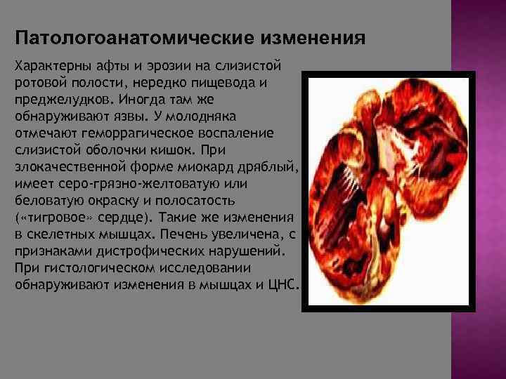 Патологоанатомические изменения Характерны афты и эрозии на слизистой ротовой полости, нередко пищевода и преджелудков.