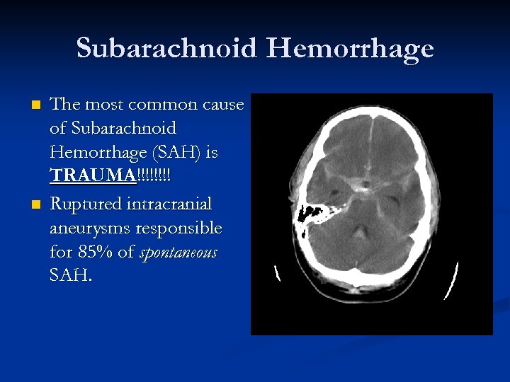 Subarachnoid Hemorrhage n n The most common cause of Subarachnoid Hemorrhage (SAH) is TRAUMA!!!!