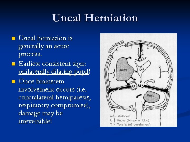 Uncal Herniation n Uncal herniation is generally an acute process. Earliest consistent sign: unilaterally