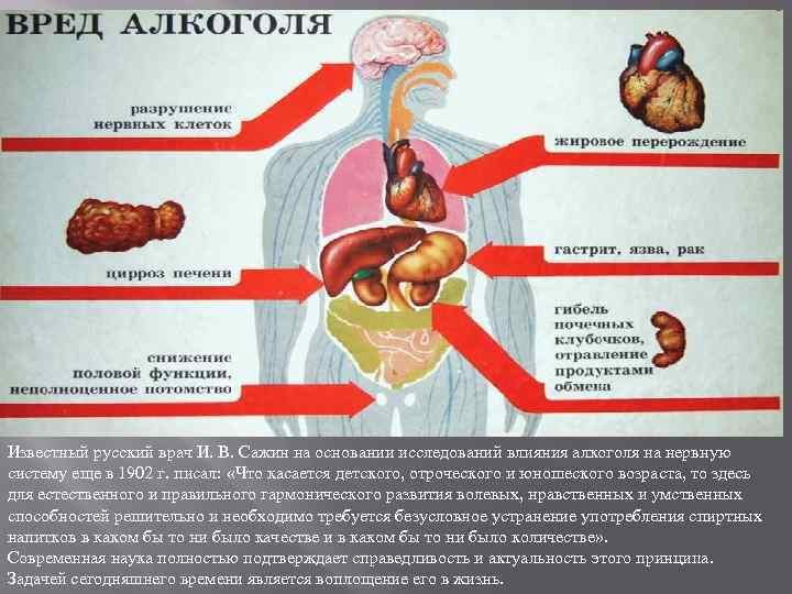 Известный русский врач И. В. Сажин на основании исследований влияния алкоголя на нервную систему