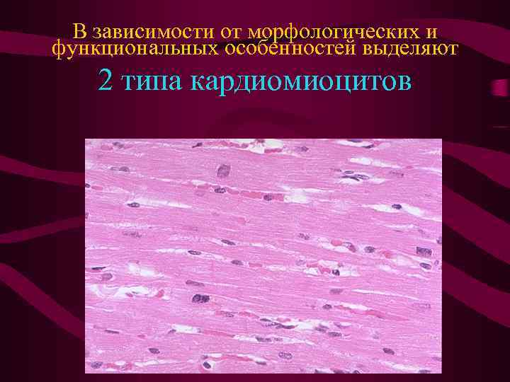 В зависимости от морфологических и функциональных особенностей выделяют 2 типа кардиомиоцитов 