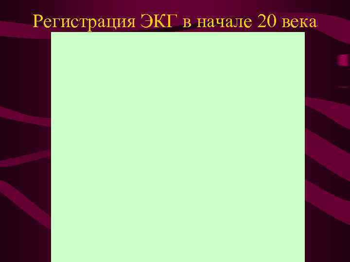 Регистрация ЭКГ в начале 20 века 