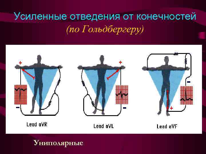 Усиленные отведения от конечностей (по Гольдбергеру) Униполярные 