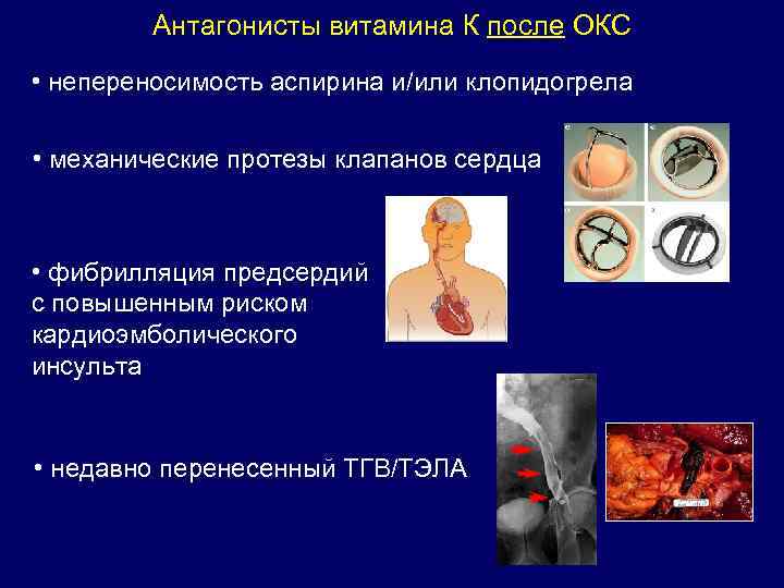 Антагонисты витамина К после ОКС • непереносимость аспирина и/или клопидогрела • механические протезы клапанов