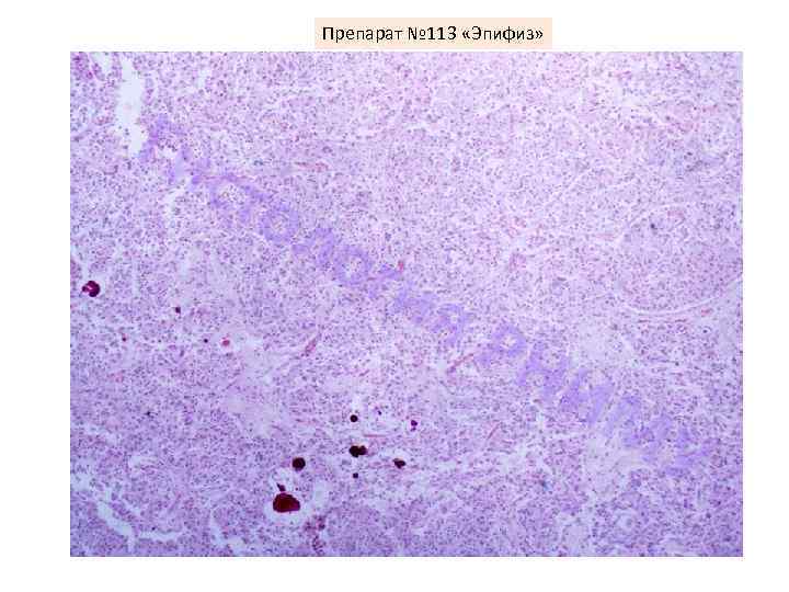 Препарат № 113 «Эпифиз» Ги сто ло гия РН ИМ У 