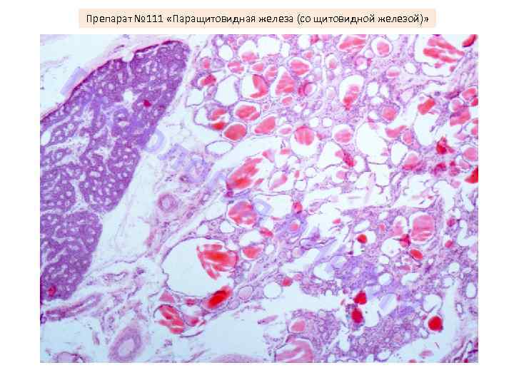 Щитовидная железа препарат. Паращитовидная железа гистология препарат. Щитовидная железа гистология гистология препарат. Околощитовидная железа гистология препарат. Паращитовидная железа микропрепарат гистология.