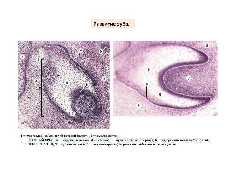Развитие зуба. 1 — многослойный эпителий ротовой полости; 2 — эмалевый тяж; 3 —