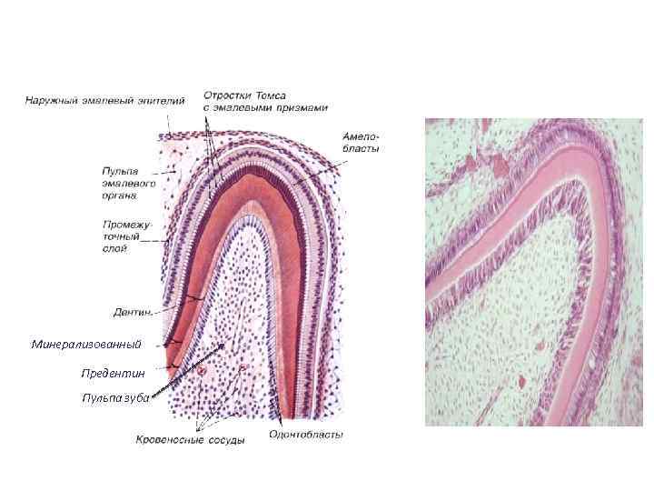 Минерализованный Предентин Пульпа зуба 