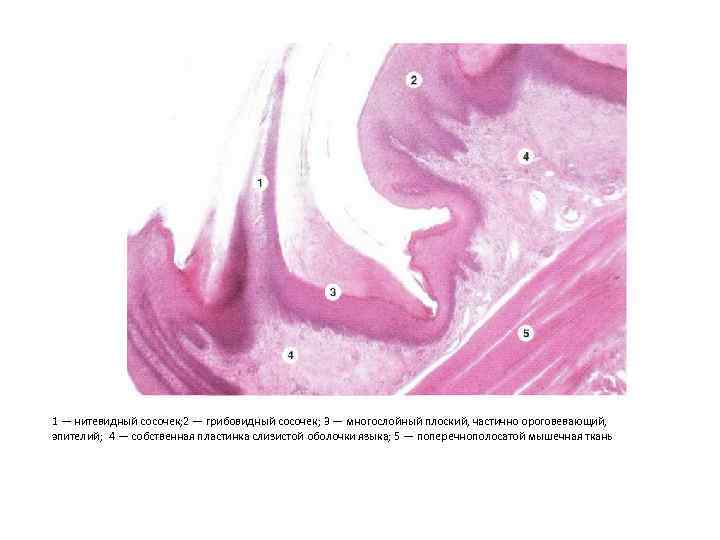 Гистология нитевидные сосочки языка рисунок
