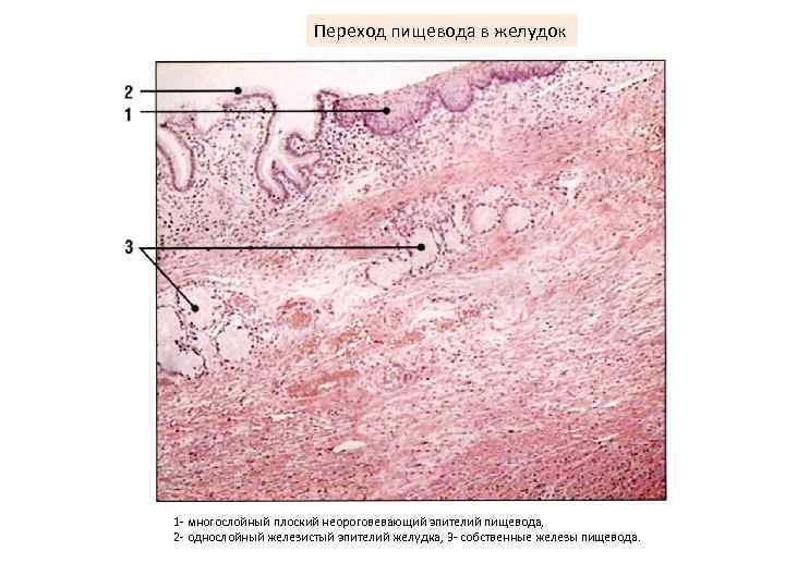 Переход пищевода в желудок 1 многослойный плоский неороговевающий эпителий пищевода, 2 однослойный железистый эпителий