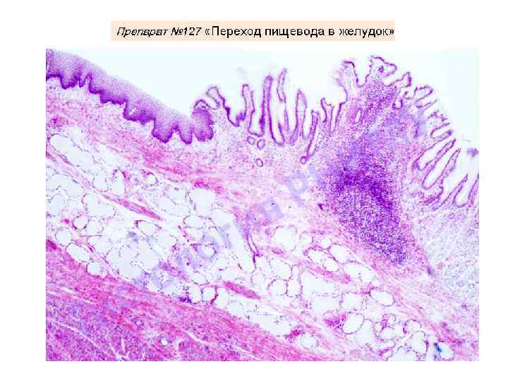 Переход пищевода в желудок гистология рисунок