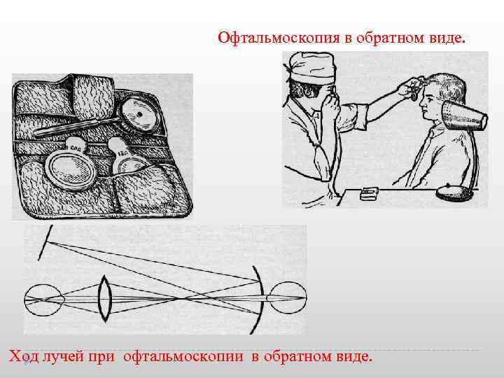 Офтальмоскопия в обратном виде. Ход лучей при офтальмоскопии в обратном виде. 