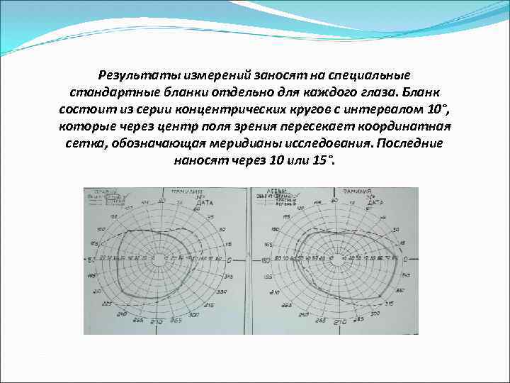 Результаты измерений заносят на специальные стандартные бланки отдельно для каждого глаза. Бланк состоит из
