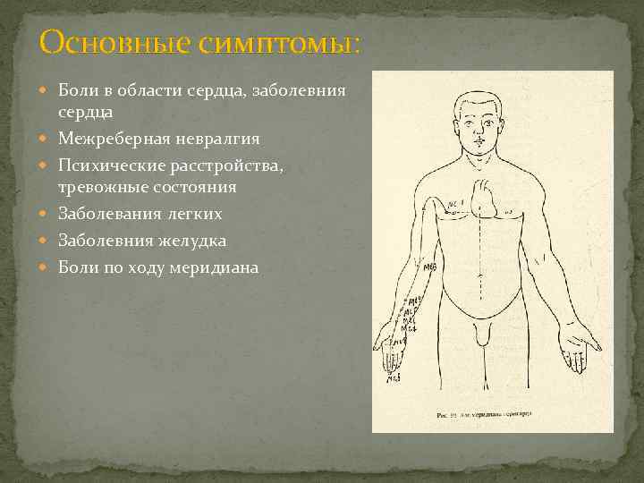 Основные симптомы: Боли в области сердца, заболевния сердца Межреберная невралгия Психические расстройства, тревожные состояния