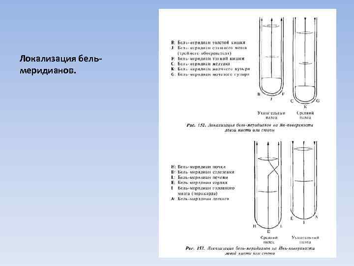 Локализация бельмеридианов. 12 