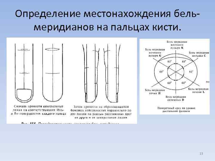Определение местонахождения бельмеридианов на пальцах кисти. 13 