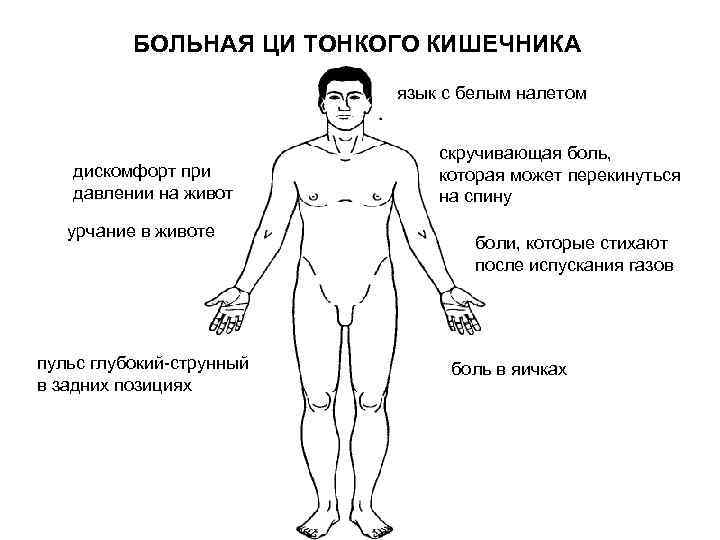 БОЛЬНАЯ ЦИ ТОНКОГО КИШЕЧНИКА язык с белым налетом дискомфорт при давлении на живот урчание