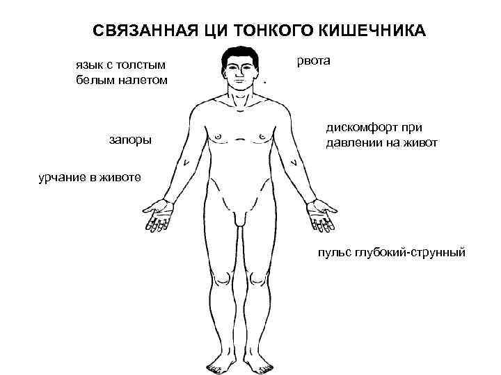 СВЯЗАННАЯ ЦИ ТОНКОГО КИШЕЧНИКА язык с толстым белым налетом запоры рвота дискомфорт при давлении
