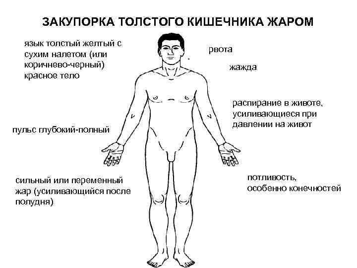 ЗАКУПОРКА ТОЛСТОГО КИШЕЧНИКА ЖАРОМ язык толстый желтый с сухим налетом (или коричнево черный) красное