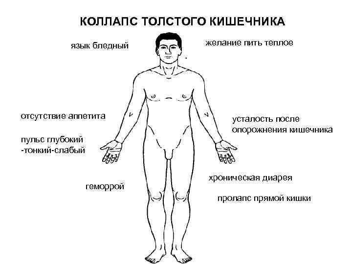 КОЛЛАПС ТОЛСТОГО КИШЕЧНИКА язык бледный отсутствие аппетита желание пить теплое усталость после опорожнения кишечника