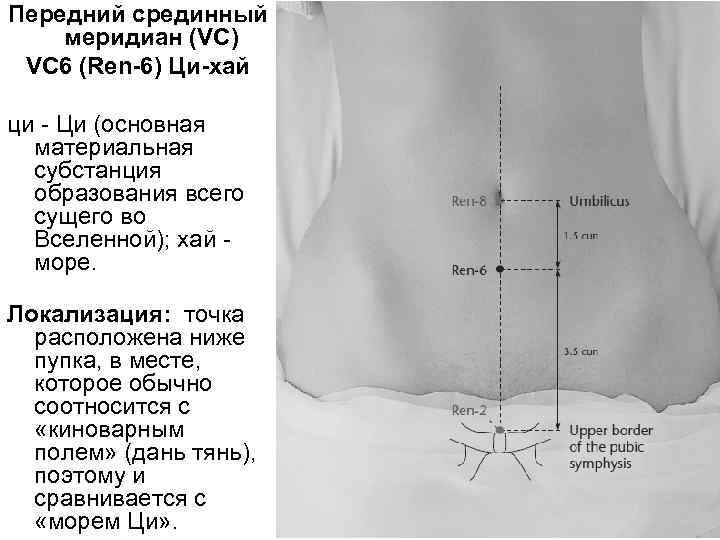 Передний срединный меридиан (VC) VC 6 (Rеn-6) Ци-хай ци Ци (основная материальная субстанция образования