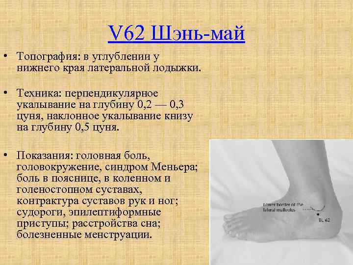 V 62 Шэнь-май • Топография: в углублении у нижнего края латеральной лодыжки. • Техника: