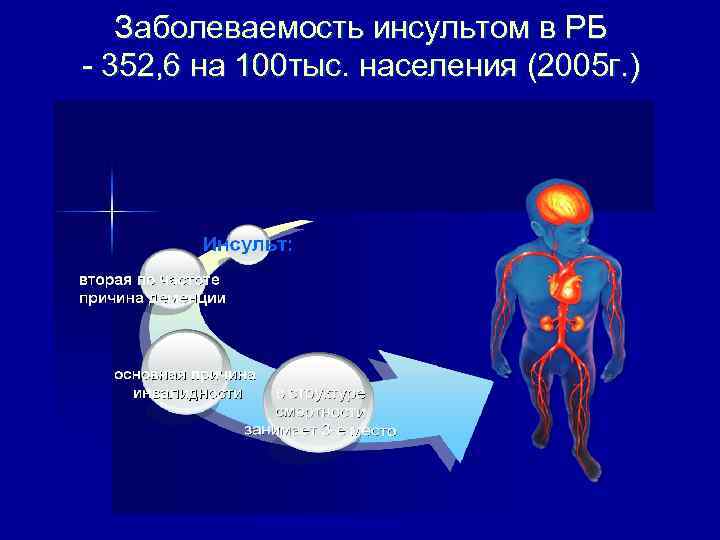 Заболеваемость инсультом в РБ - 352, 6 на 100 тыс. населения (2005 г. )