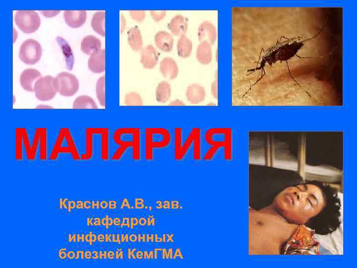 МАЛЯРИЯ Краснов А. В. , зав. кафедрой инфекционных болезней Кем. ГМА 