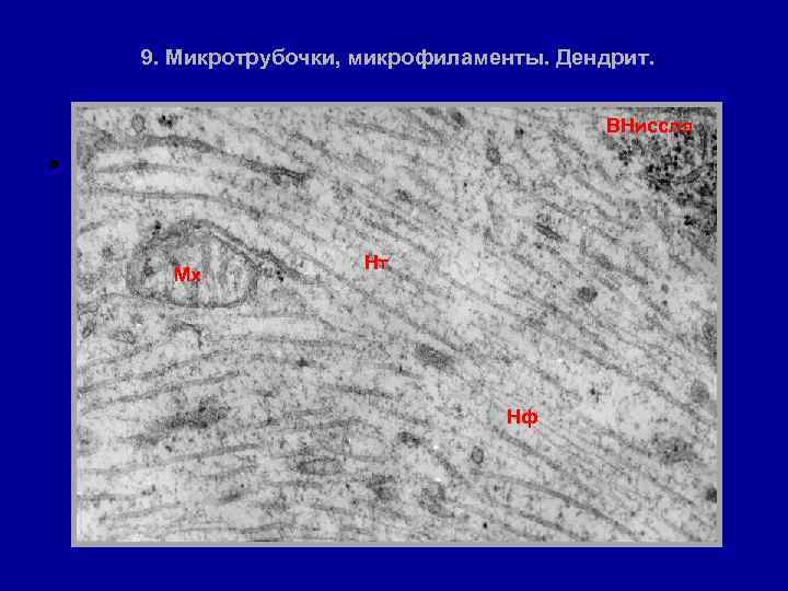9. Микротрубочки, микрофиламенты. Дендрит. ВНиссля • Мх Нт Нф 
