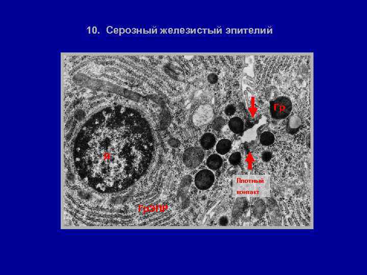 10. Серозный железистый эпителий Гр Я Плотный контакт Гр. ЭПР 