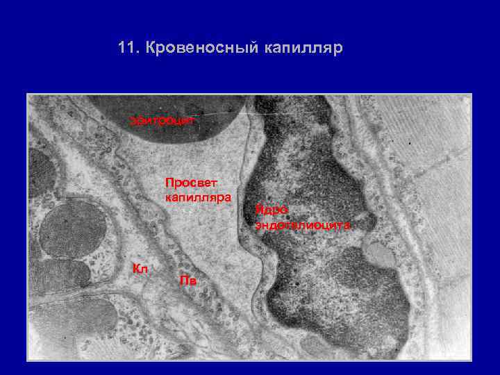 11. Кровеносный капилляр • эритроцит Просвет капилляра Кл Пв Ядро эндотелиоцита 